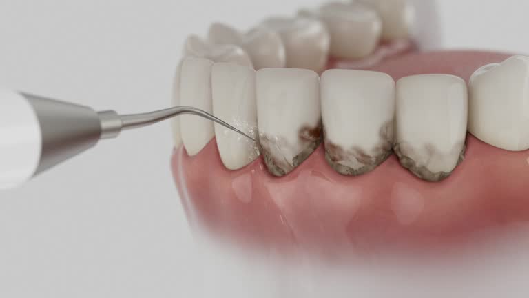 Reliable Teeth Whitening contractor in Tomahawk, WI by Smile Center Dentistry